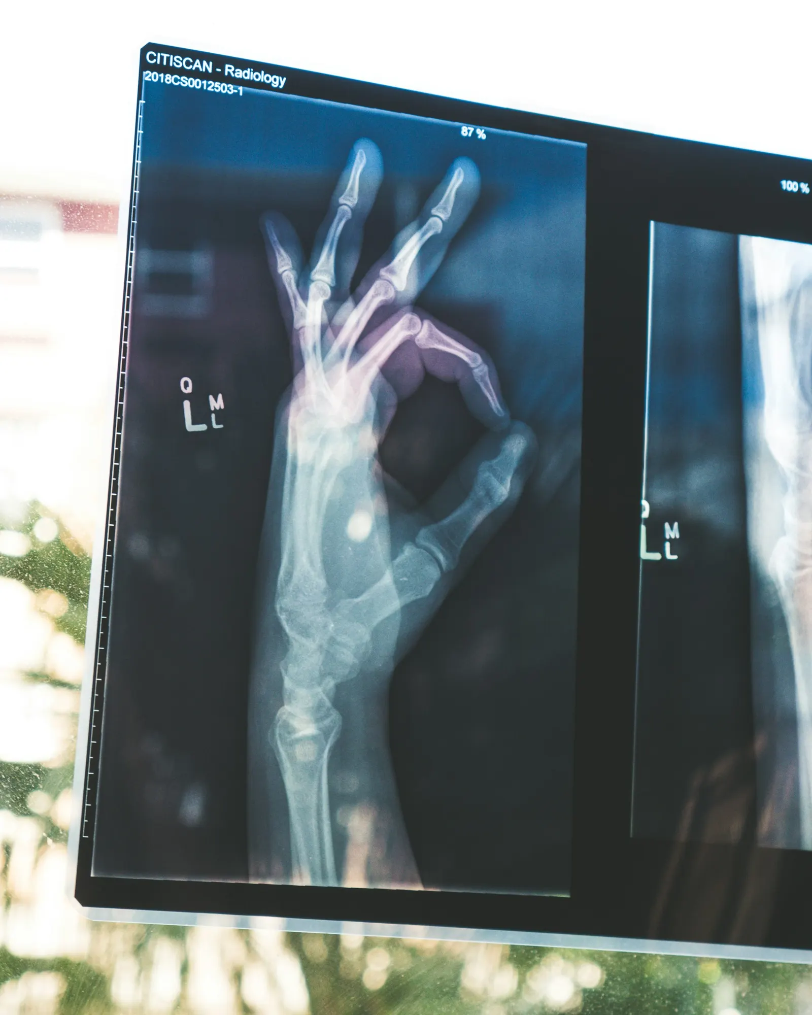 Health and Medical Scams: Protecting Yourself from Fraudulent Practices